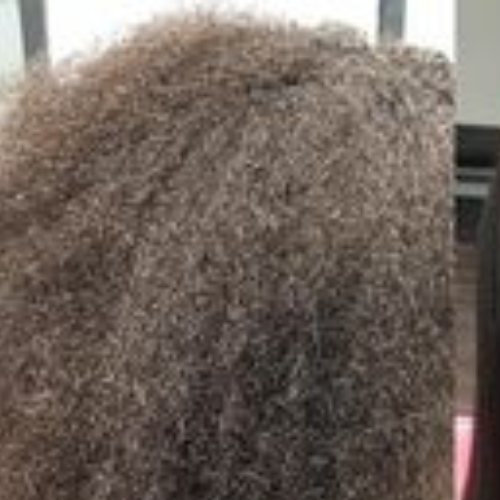 hair growth serum