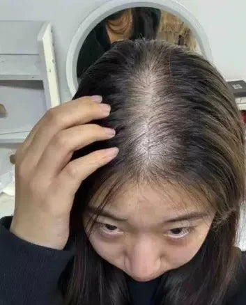 Say Goodbye to Hair Loss: Natural Ingredients That Help Stimulate Growth